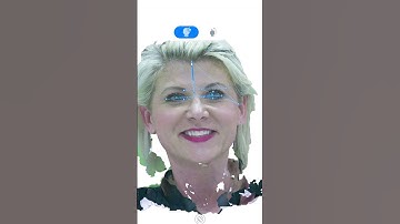 MetiSmile Dental Face Scanner
