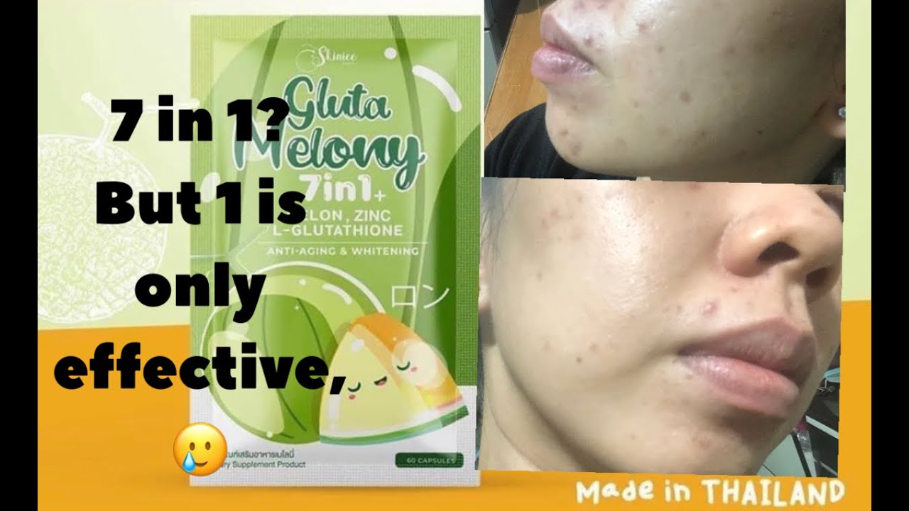 melony glutathione Thiogenesis Therapeutics
