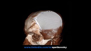 Tomography and 3d model fusion