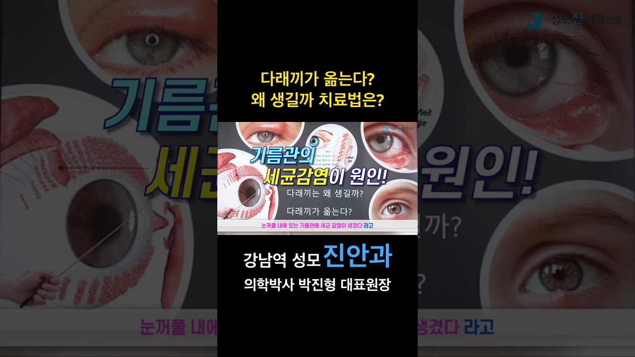 [Сонгможин Нүдний Эмнэлэг] #Хонинымах #Насныхараа #Торлогбүрхэвч #Нүднийэрүүлмэнд #ГаннамНүднийЭмнэлэг #Катарак #ЛАЗЕК #ЛАСИК #СонгможинНүднийЭмнэлэг #ЖинхэнэНүднийЭмнэлэг