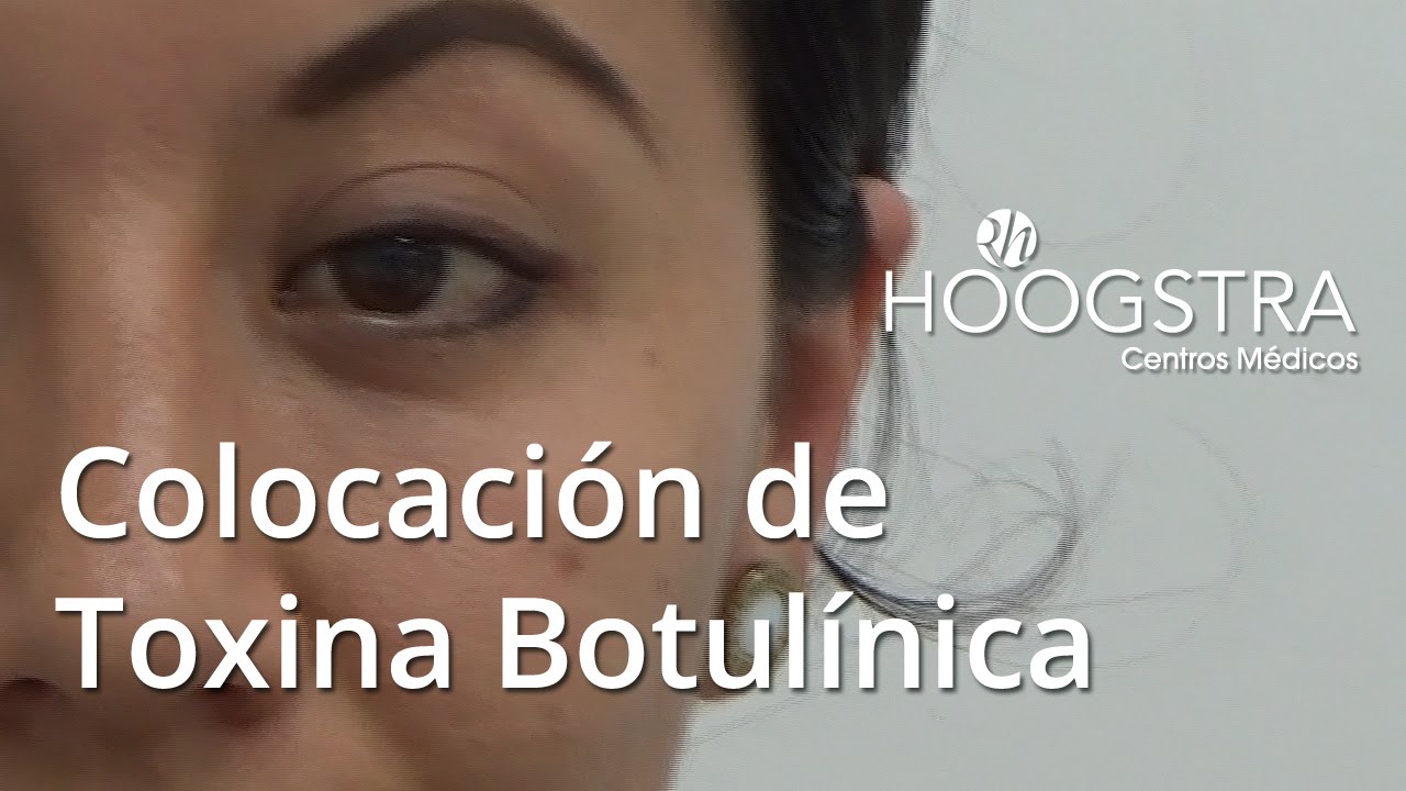 Inyección De Toxina Botulínica En Fisuras Anales Colocación de toxina botulinica (15149) - YouTube