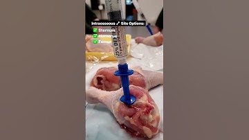 Heard of Intraosseous Line - large needle that punctures 🦴? #shorts