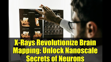 X-Rays Revolutionize Brain Mapping: Unlock Nanoscale Secrets of Neurons
