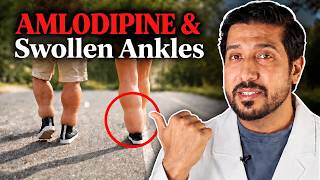 Amlodipine Causing Swollen Ankles? Do THIS