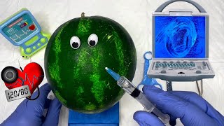 Mr.Surgeon Fruit Surgery | Watermelon Emergency Surgeon