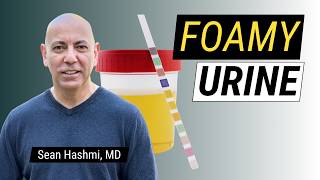 Foamy Urine: 1 in 5 Times Your Kidneys Are Leaking