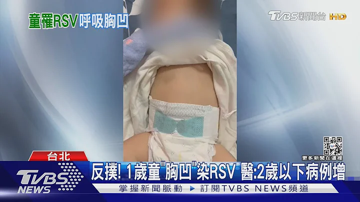 反扑! 1岁童“胸凹”染RSV 医:2岁以下病例增｜TVBS新闻 - 天天要闻