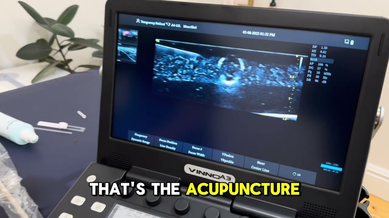 Needle Visualisation and MSK imaging on the VINNO A3