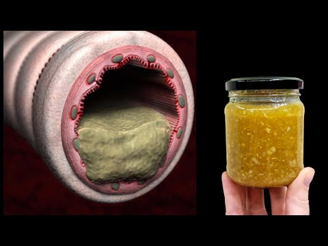 Schneidet Husten wie ein Messer! schleimlösend! Natürliches Antibiotikum!