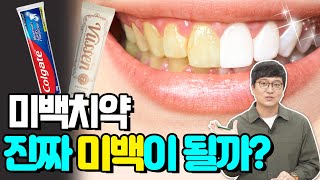 Use TOOTHPASTE To WHITEN Your YELLOW TEETH?!｜Are Whitening Toothpastes ACTUALLY Effective?