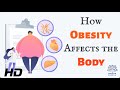 The heavy burden of obesity understanding its effects on your body