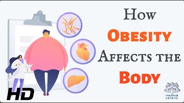 De zware last van obesitas: de effecten ervan op uw lichaam begrijpen