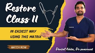 Class II Restoration with Automatrix & TOR VM Saddle Matrix | Step-by-Step Guide Profile