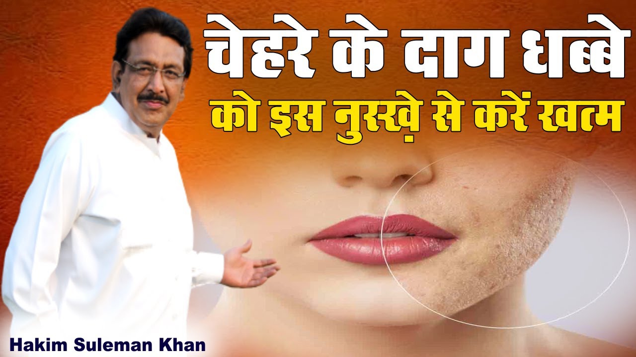 Follow this remedy to get rid of blemishes on your face Hakim Suleman Khan Sadhna TV
