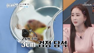 의사도 인정한 마마 담석 크기..ㄷㄷ [아내의 맛] 102회 20200616