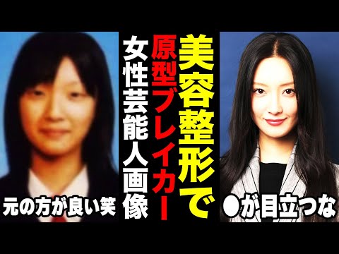 【疑惑】整形発覚！？大変身を遂げた芸能人は誰？美しすぎる16人の噂を徹底検証！整形疑惑とそのリアルとは！？