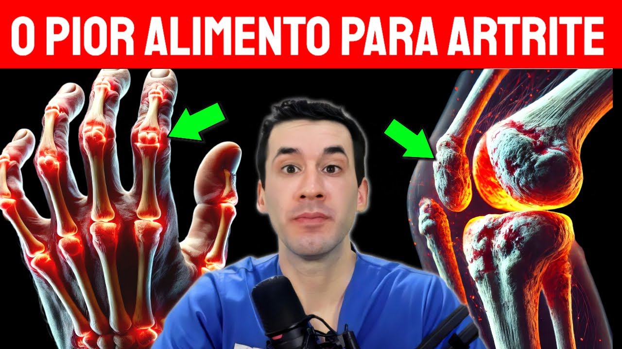 Pare de comer estes 7 alimentos se você tem artrite (o que comer em vez disso)