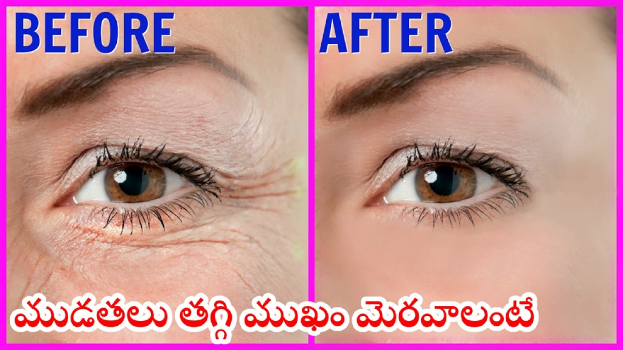 Remove Eye Wrinkles Tips in Telugu. YouTube