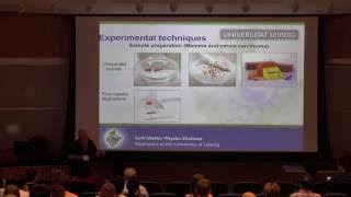 Why do rigid tumors contain soft cancer cells? screenshot 5