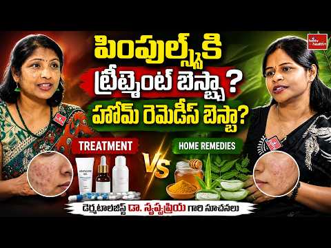 పింపుల్స్‌కి ట్రీట్మెంట్ బెస్టా? హోమ్ రెమెడీస్ బెస్టా? | hmtv health plus