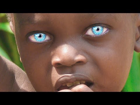 Video: In Kalifornien Verbreitet Sich Eine Ungewöhnliche Mutation Blauer Augen Unter Kojoten - Alternative Ansicht