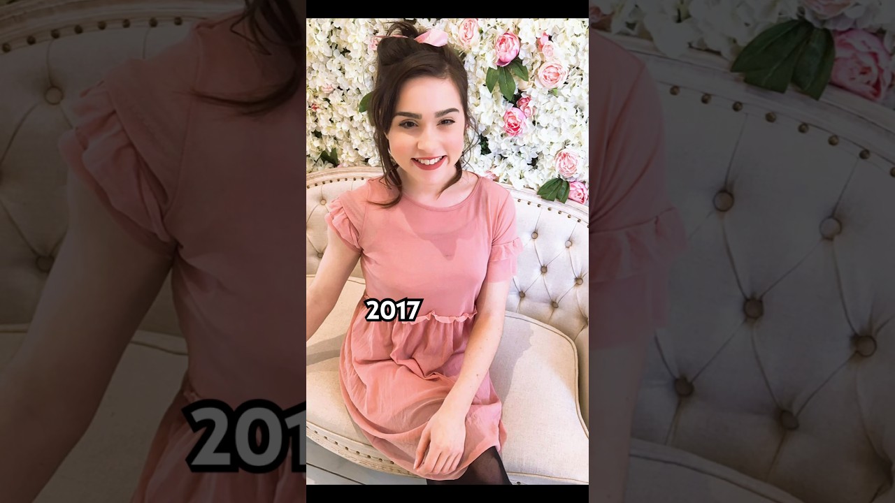 Did losing an eye give me a glow up? 👁️ AD #glowup