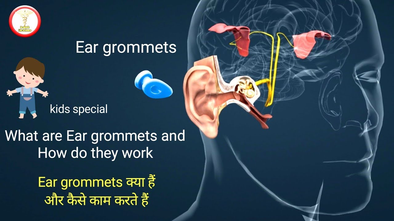 Middle Ear Infection Treatment In Hindi Ear Grommet Ear Discharge