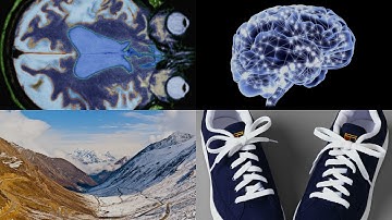 Treating Traces of Trauma, Why Your Shoes Are Untied, and More: 60 Second Science Podcasts