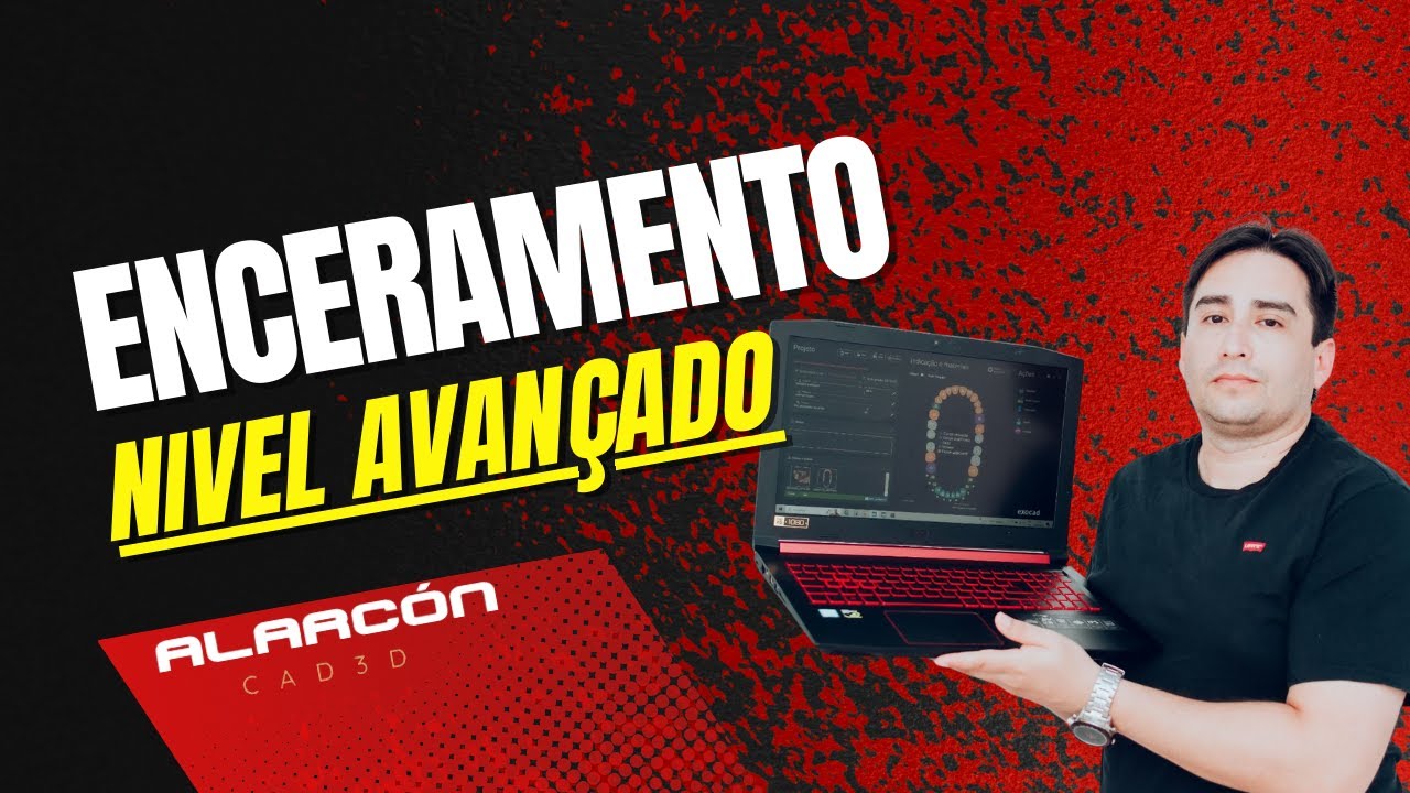 ENCERAMENTO NIVEL AVANÇADO #fluxodigital #exocad