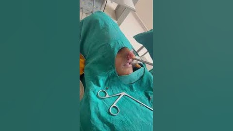 Nasal Disorders and Treatment for Nasal Polyps