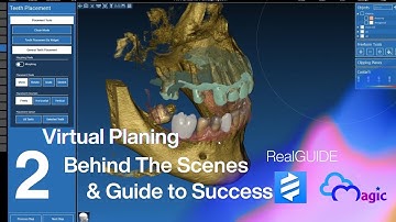 RealGuide tutorial Episode 2 اضافة DICOM و STL file و crown