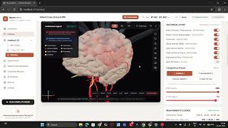 Neuro Mirror | AI-Powered Brain Treatment Simulation & Safety Assistant