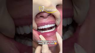 Вишукана робота лікаря Бараник Анастасії😍#dentist #dentalclinic #dnipro #ukraine