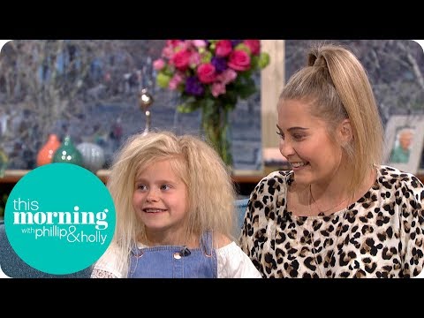 Video: The Only Twins In The World With Uncombed Hair Syndrome - Alternative View
