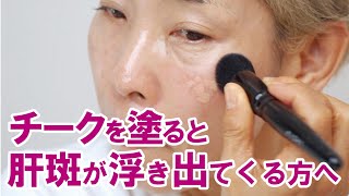 【肝斑さん】チークを塗ると肝斑が浮き出てしまう時の対策