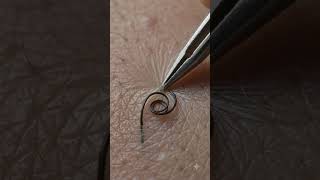 🔥 Giant Blackhead Extraction in Extreme Macro 4K | Satisfying Pore Cleaning