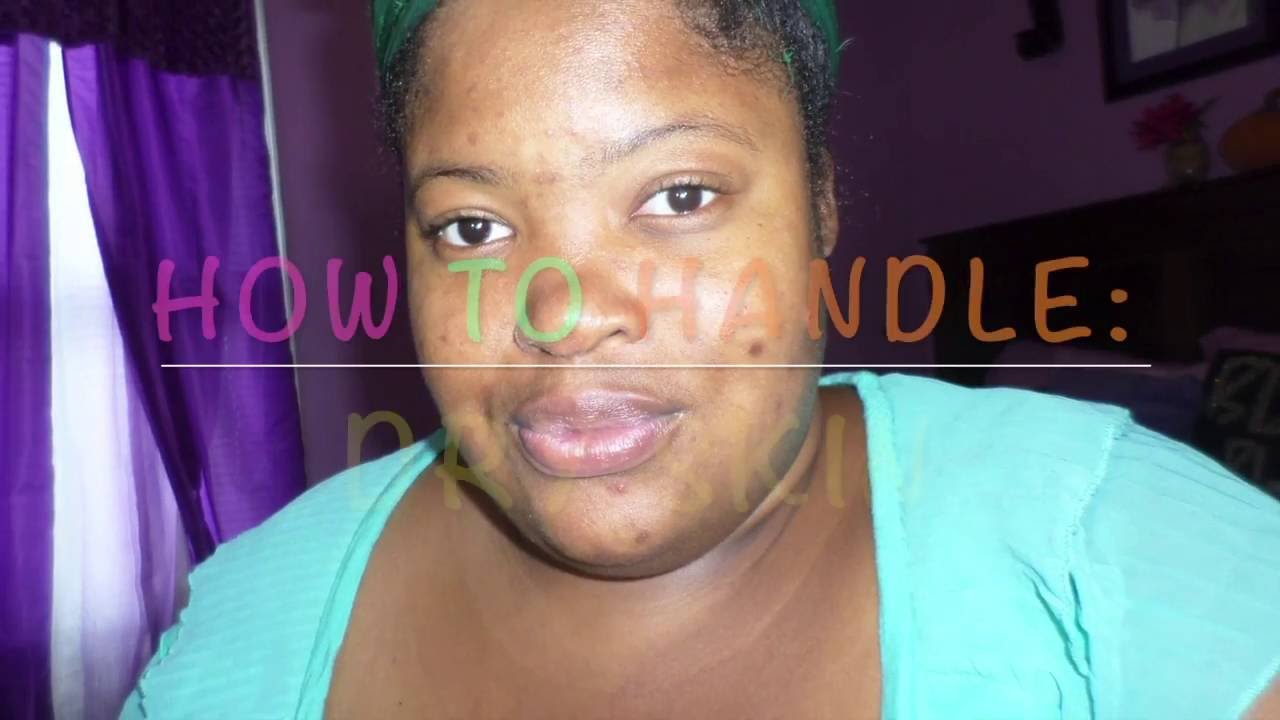 HOW TO: MANAGE DRY SKIN DAILY | SKIN CARE ROUTINE FOR DRY SKIN 