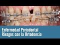 Ortodoncia y salud periodontal | Juan Salgado |  enfermedades periodontales