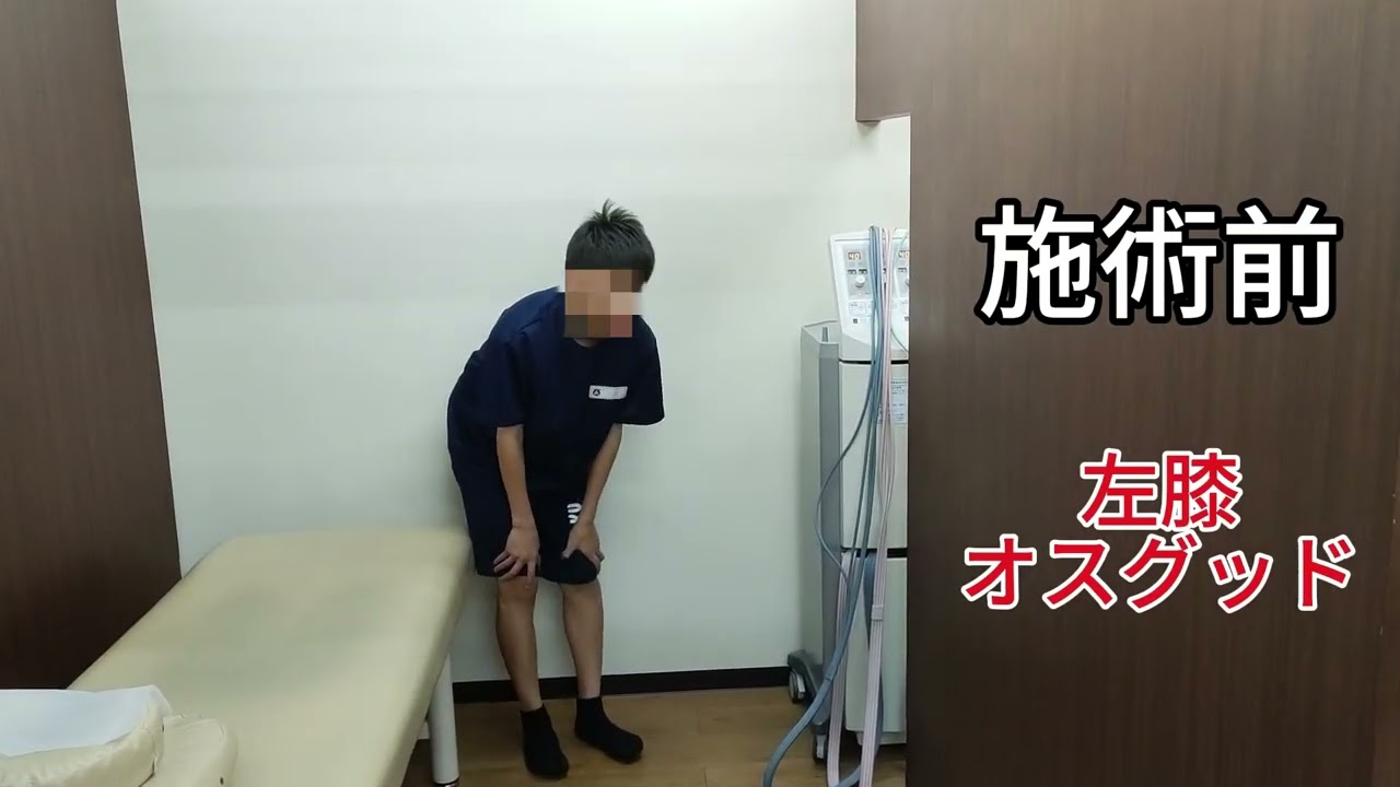 オスグッド施術　beforeAfter①