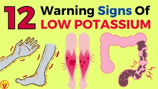 12 Warning Signs Of Low Potassium In The Body (Don't Ignore These!)| Potassium Deficiency | VisitJoy