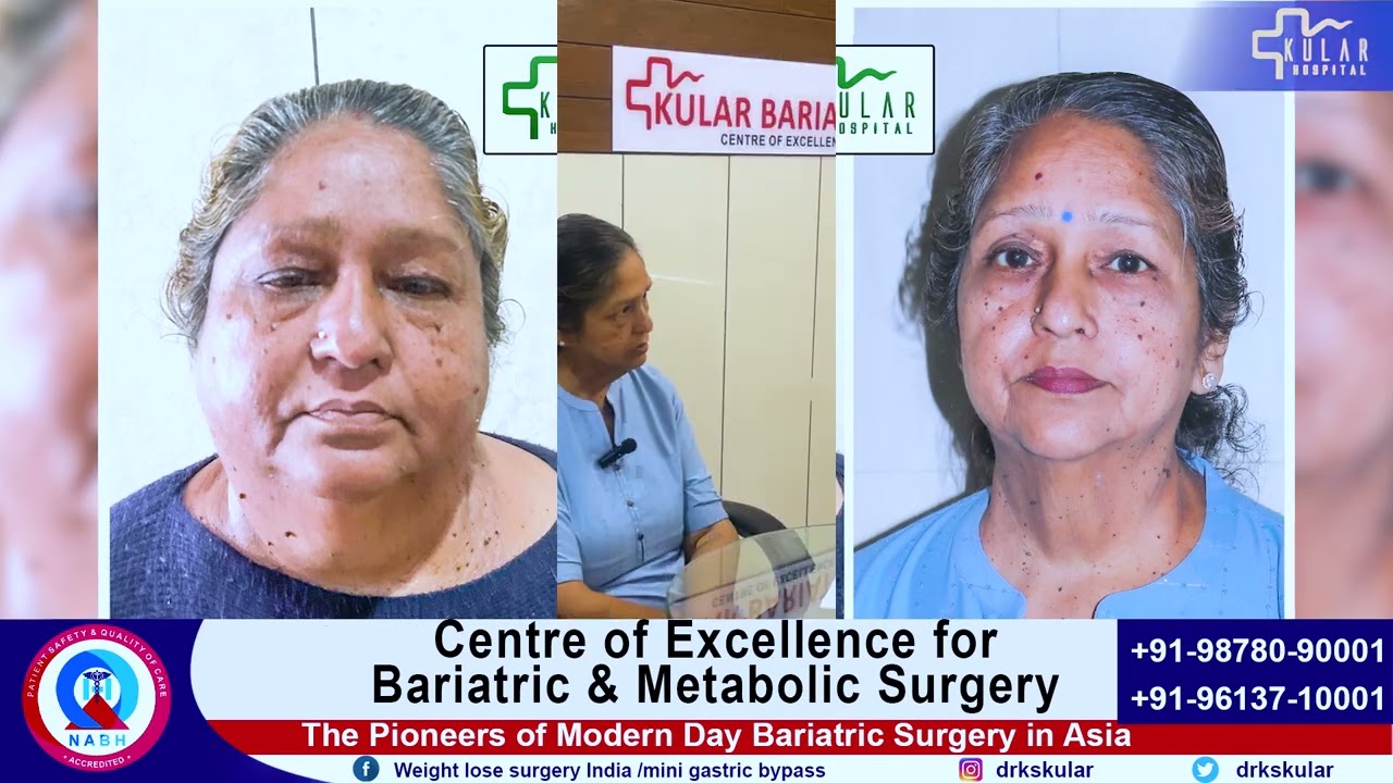 Awareness on MGB Reversal: Overcoming Dumping and Food Intolerance