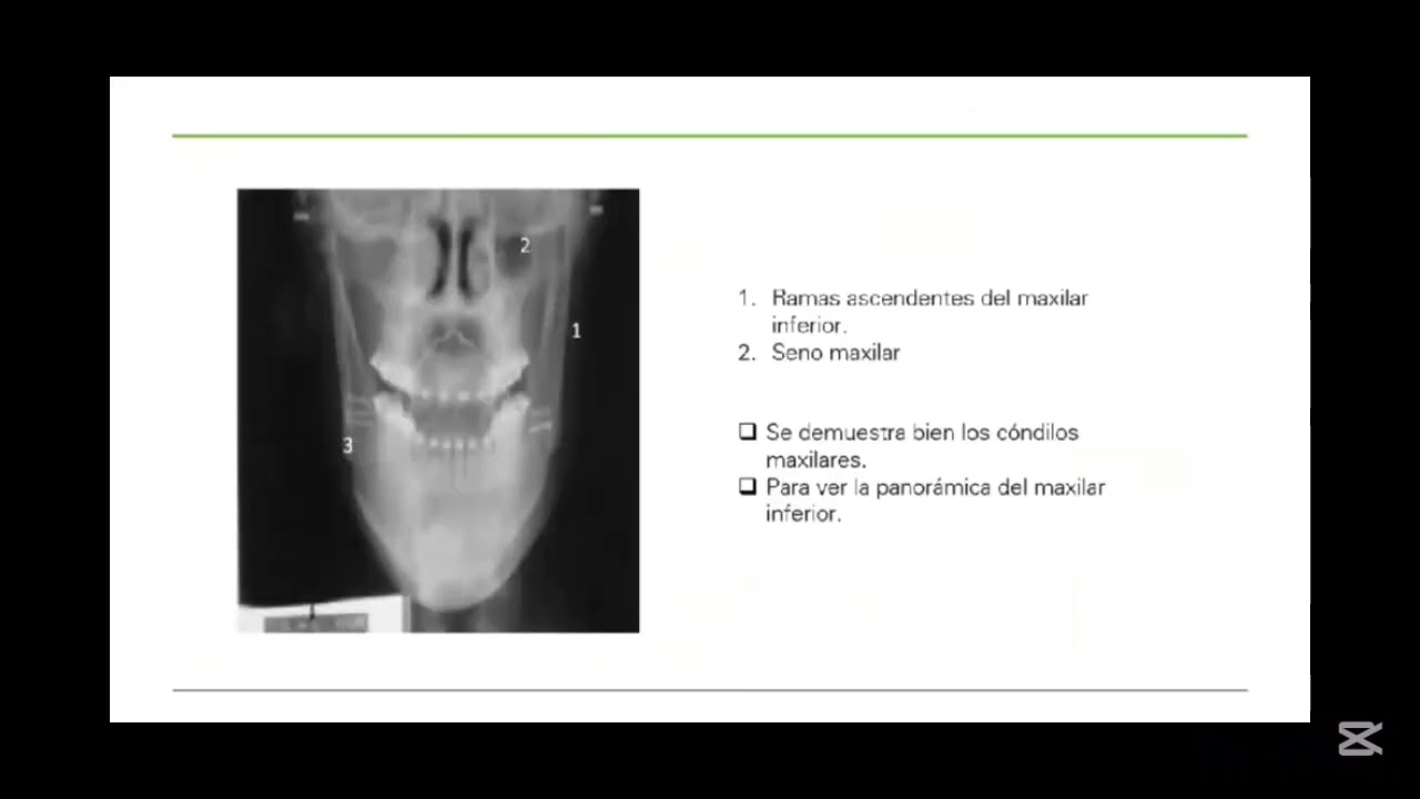POCISION DE MAXILAR INFERIOR Y SUS RUTINAS 