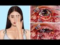 Asmr remove glasses  worm infected dirty eyes  deep cleaning animation