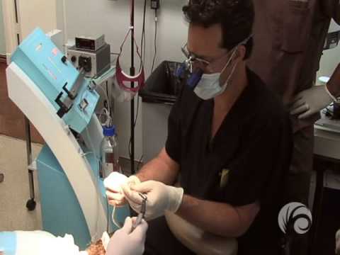 NeoGraft Hair Transplant Surgery - Performed by Dr...