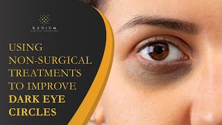 Using Non-Surgical Treatments To Improve Dark Eye Circles