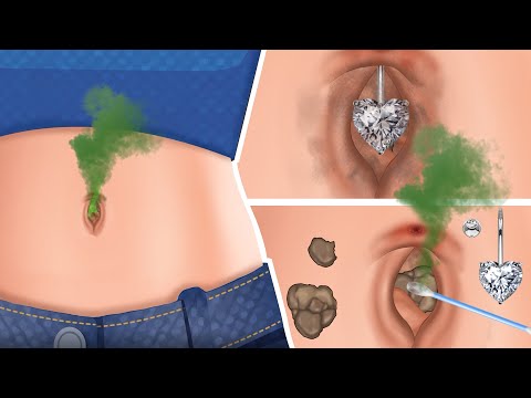 ASMR How to best treatment and clean navel piercings, navel stones | 현실적인 케어 트리트먼트 애니메이션 2023