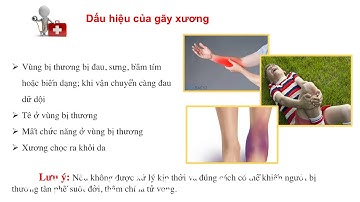 Sơ cứu khi gãy xương