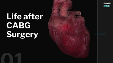 Life after CABG Surgery