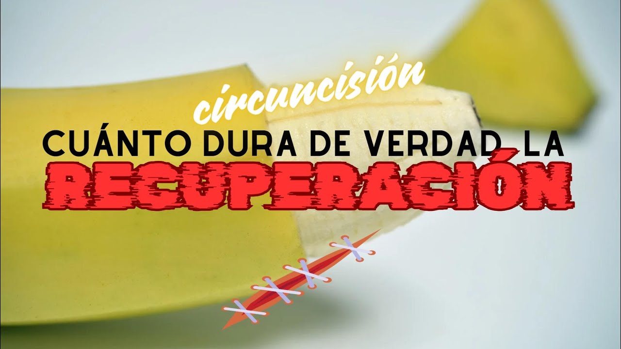 Cuánto dura la recuperación de la circuncisión (y otras 2 dudas)