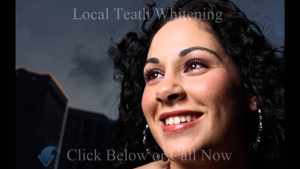 Laser Teeth Whitening Calgary Call (877)9272387 YouTube